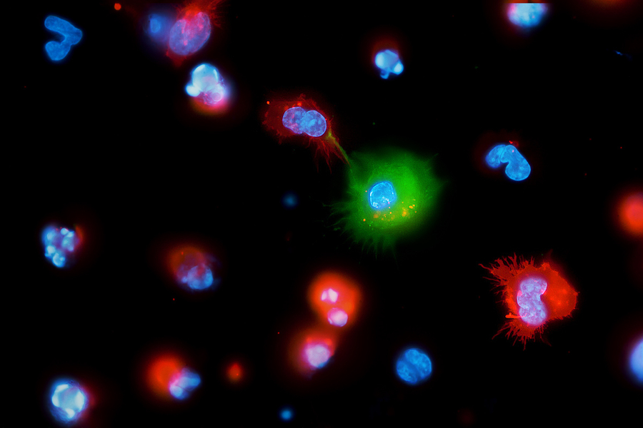 contact formation between NK-92 (red) and hemophagocyte (green)