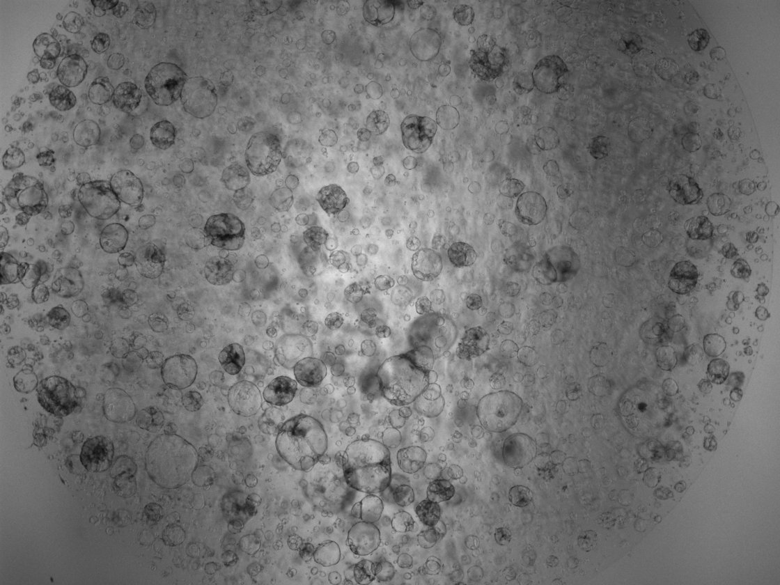 Microscopic image of organoids in Matrigel