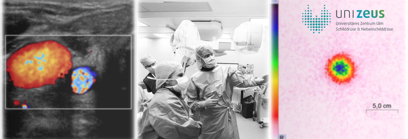 Bildercollage bestehend aus zwei medizinischen Aufnahmen und ein Foto aus dem Operationssaal