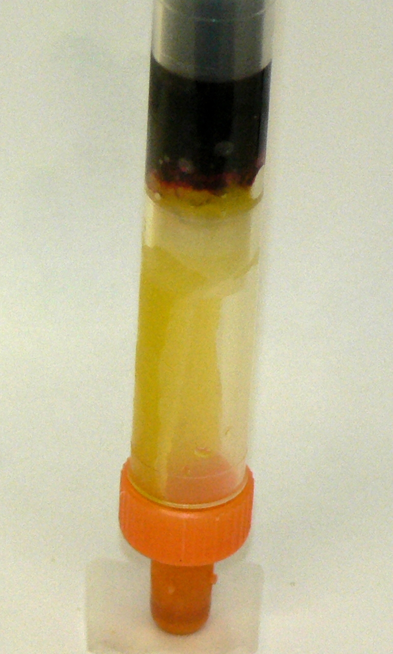 Foto einer Li-Heparin-Monovette mit gefrorenem Plasma.