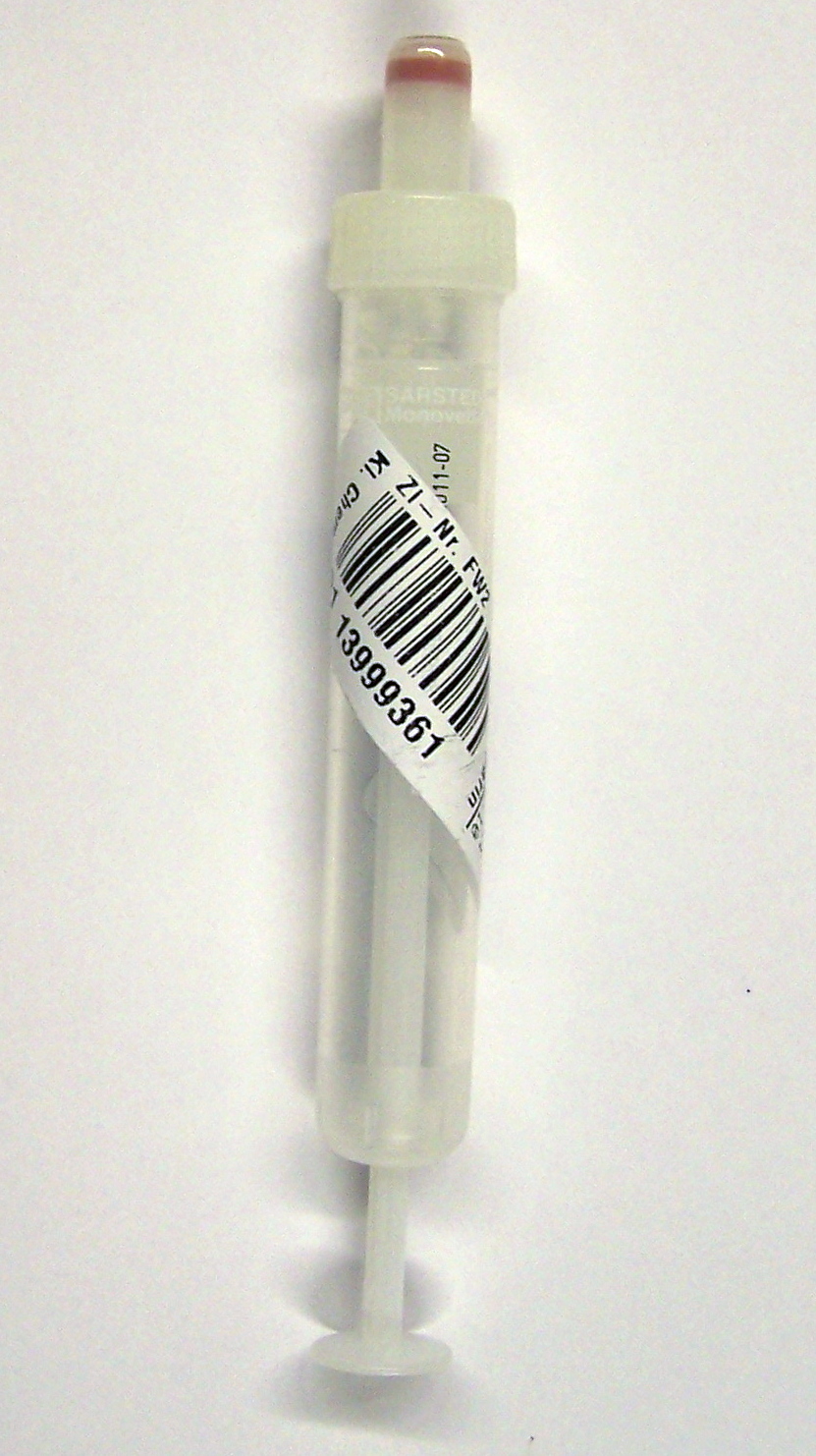 Bild einer Serum-Monovette die schräg mit dem Patientenetikett beklebt ist.