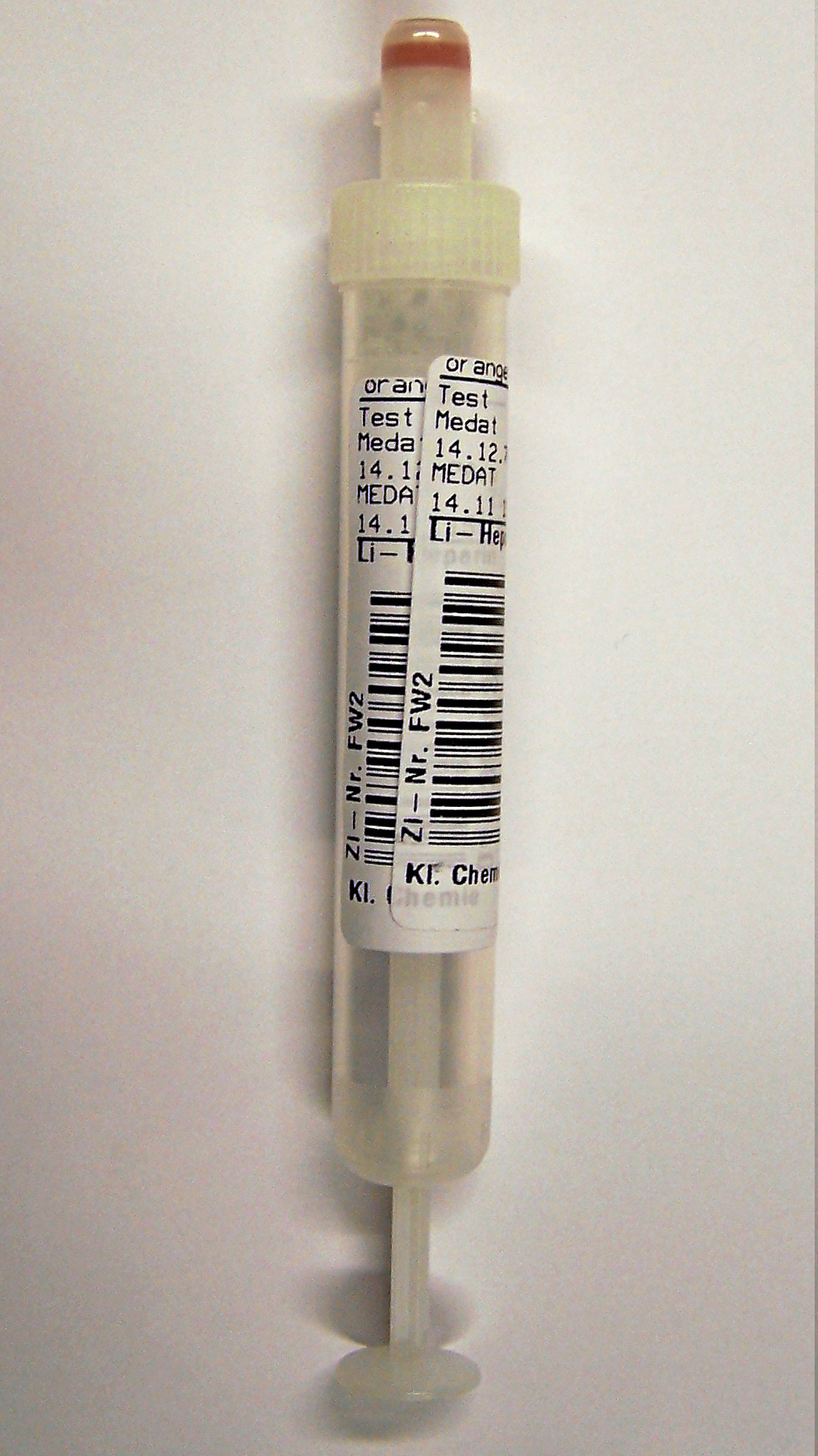 Bild einer Serummonovette die mit 2 Patientenetiketten übereinander beklebt ist.