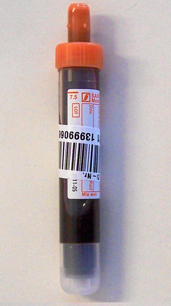Bild einer Lithium-Heparin-Monovette die quer mit dem Patientenetikett beklebt ist.