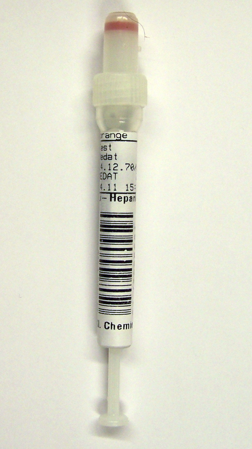Foto einer 1,8 ml Serum-Monovette. Diese ist komplett mit dem Patientenentikett beklebt. Man sieht keinen Füllstand.