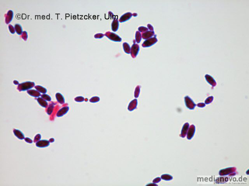 Candida albicans (Grampräparat)