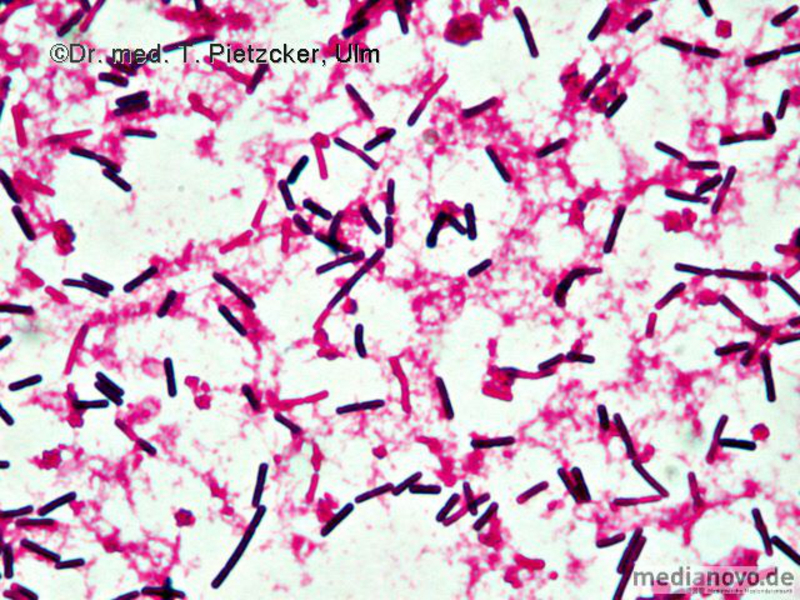 Clostridium perfringens (Mikroskopie)