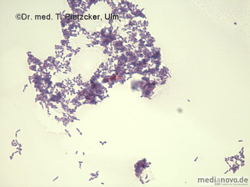 Nocardia spp. (verkürzte Ziehl-Neelsen-Färbung)