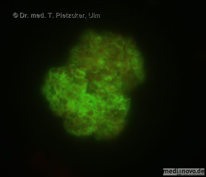 Pneumocystis carinii (Immun-Fluoreszenz-Test)