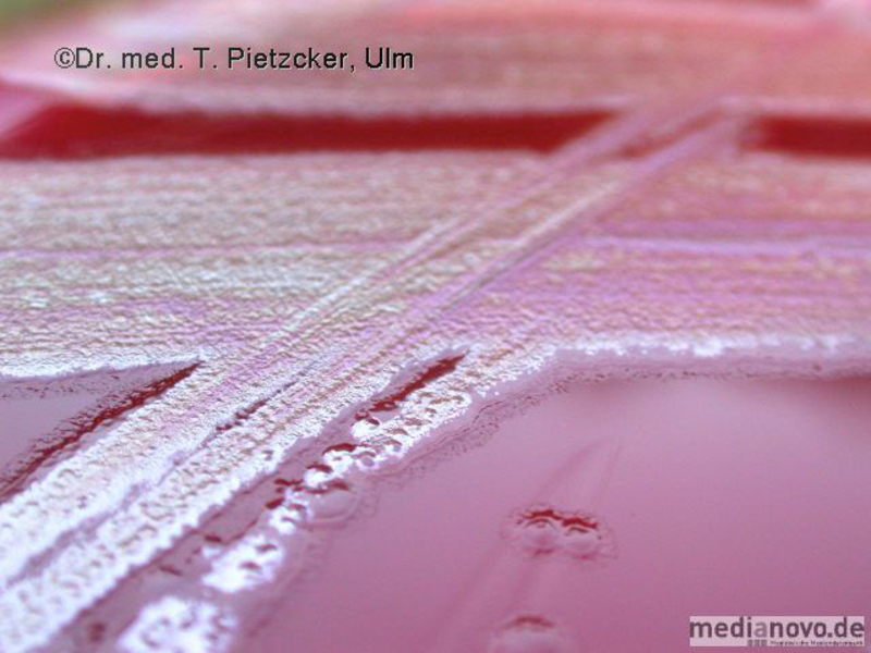 Pseudomonas aeruginosa (auf Blut-Agar)