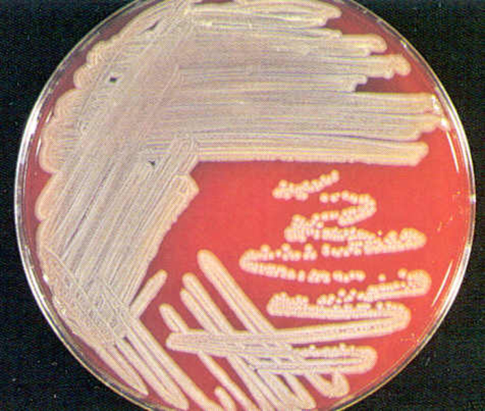 Stenotrophomonas maltophilia (auf Blutagar)