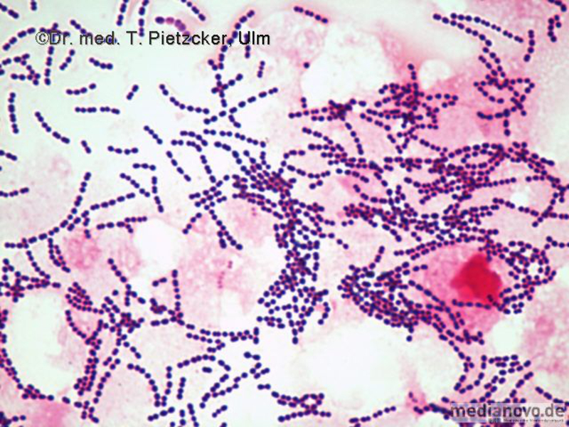 Streptococcus spp. Gram-Präparat (Mikroskopie)