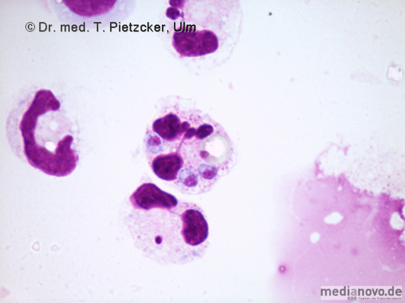 Toxoplasma gondii (Giemsa-Färbung)