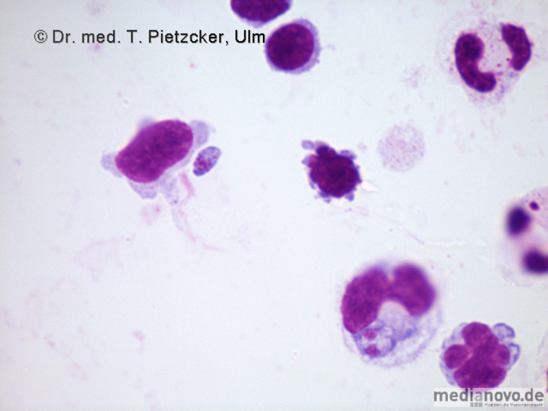 Toxoplasma gondii (Giemsa-Färbung)