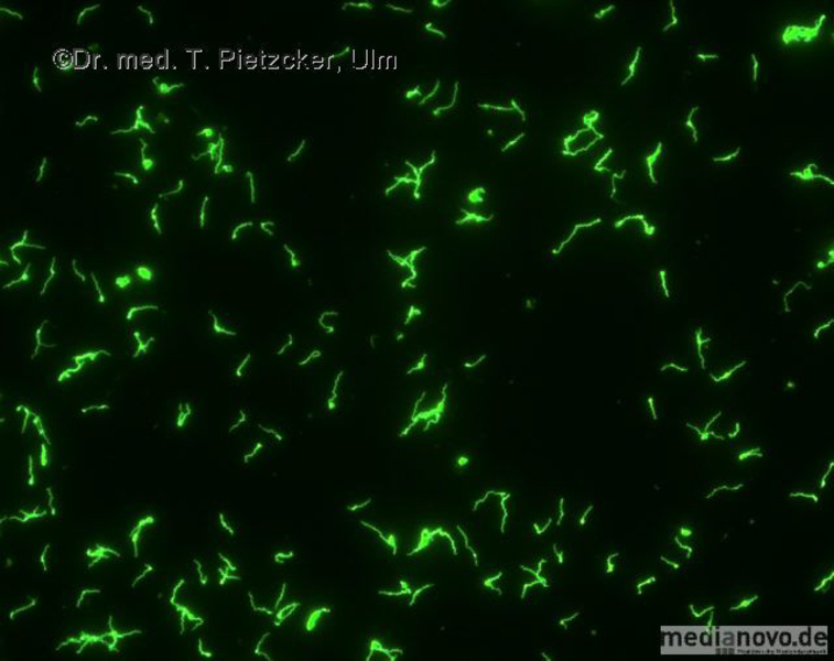 Treponema pallidum (Fluoreszenzmikroskopie (FTA-Abs-IgG))