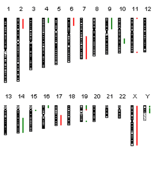 „Shared Copy Number Variation (CNV) in gleichzeitigem Nephroblastom und Neuroblastom durch Fanconi-Anämie.“