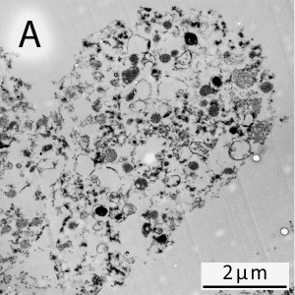 Electron microscopy (TEM) of CSF EVs (Paschke et al., in preparation)