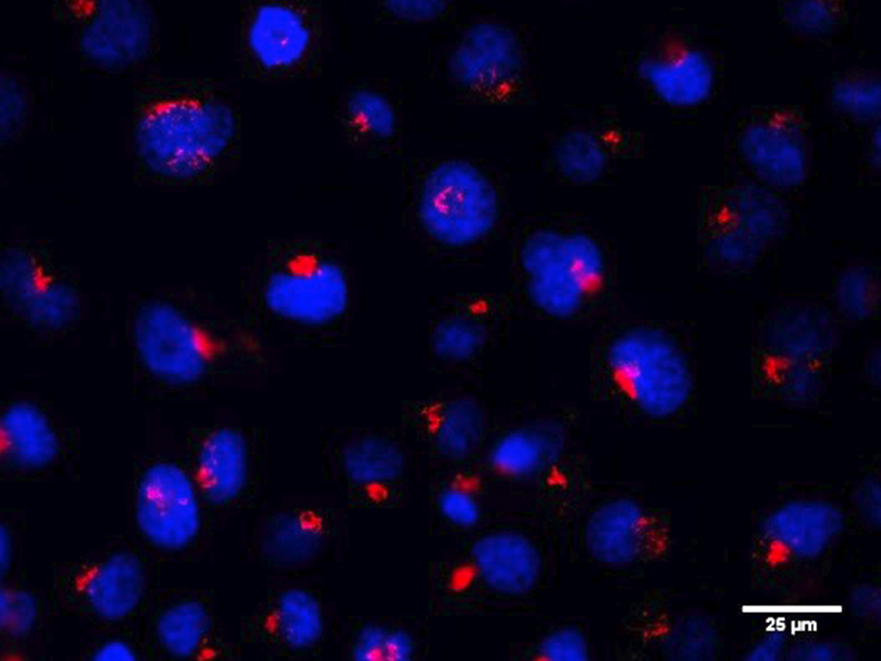 Fluoreszierende Zellen