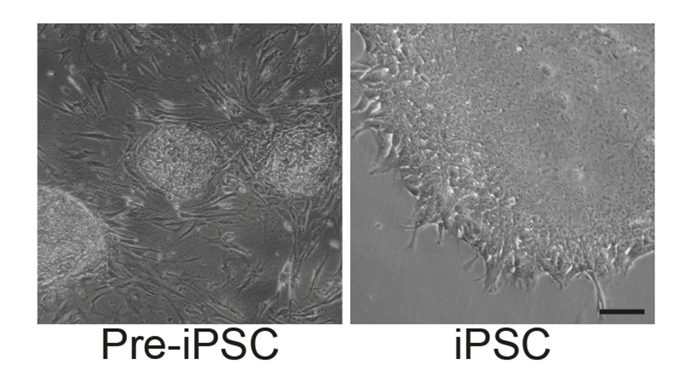 mikroskopische Aufnahme von Pre-iPSCs und iPSCs