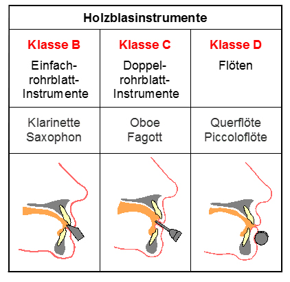 Abbildung: Graphische Darstellung der Zahnfehlstellungen durch  das Spielen von Blasinstrumenten