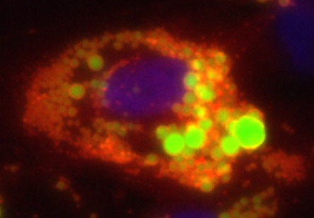 Immunofluorescent staining of perlipin. Nucleus is stained in blue, lipids in green, and perilipin in red. 