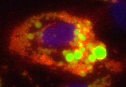 Immunofluorescent staining of perlipin. Nucleus is stained in blue, lipids in green, and perilipin in red.