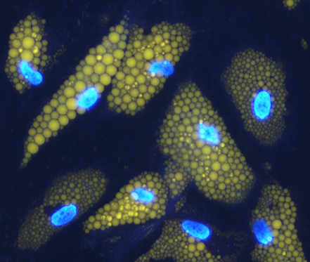 In vitro differentiated human adipocytes. Nuclei are stained in blue, lipid droplet in orange.