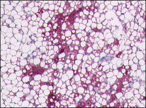 Pediatric perirenal adipose tissue. Islets of UCP1-positive brown adipocytes are present within white adipose tissue.