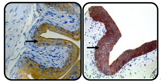 Abb. 1: Expression von ORP3 in den Epithelzellen der Harnblase (links in vivo Modell, rechts human).