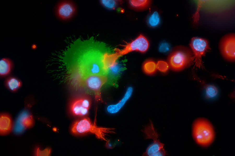 early hemophagocytosis of NK-92 and another NK-92 forming contact