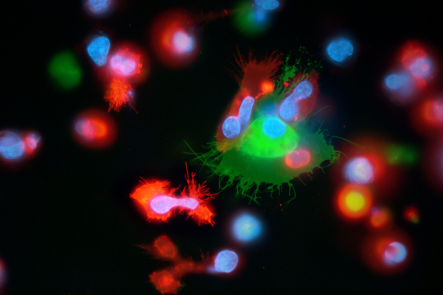 completed phagocytosis of one NK-92 and several other NK-92 cells forming contact
