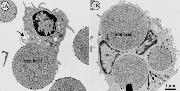 Phase contrast of cultured hemophagocyte, floating, pleomorphic morphology and veiled surface structure.