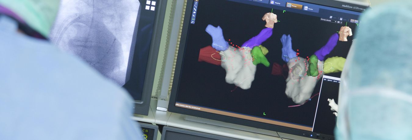 Bildschirm auf dem 3D-Modelle des Herzens zu sehen sind 