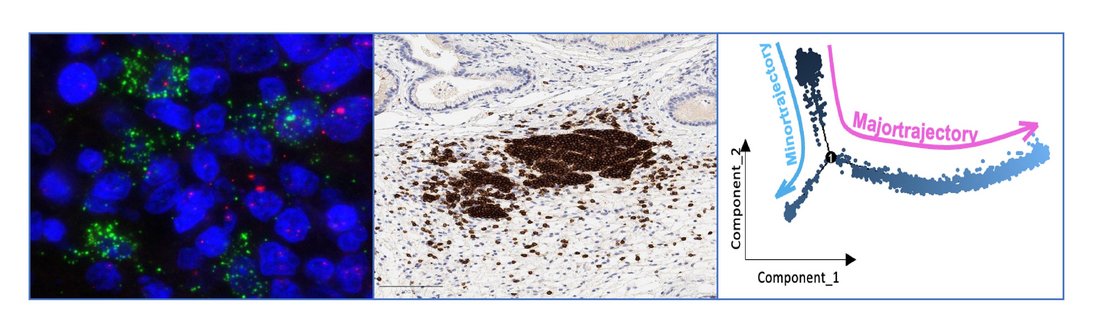 Some examples of the techniques we use in our research. From left to right: RNA Fish Immunofluorescence, Immunohistochemistry, Bioinformatic analysis of scRNA seq data.