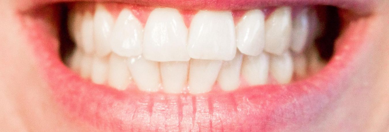 perfekter Zahnstatus einer Patientin