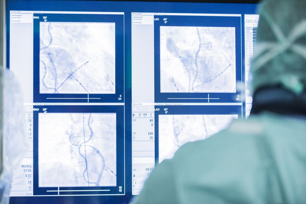 Elektrophysiologische Untersuchung Und Katheterablation Universitatsklinikum Ulm