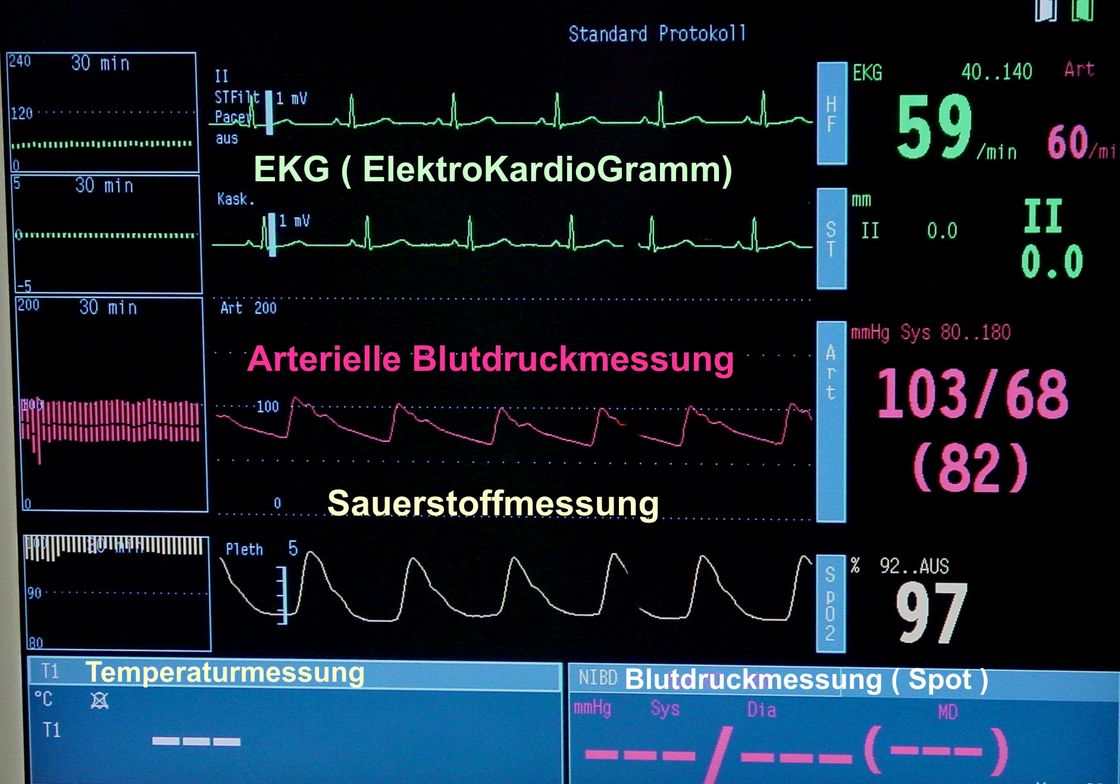 Vitalparameter auf dem Monitor