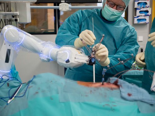 Der Roboterarm unterstützte während der Operation u.a. bei der Anbringung von Schrauben.
