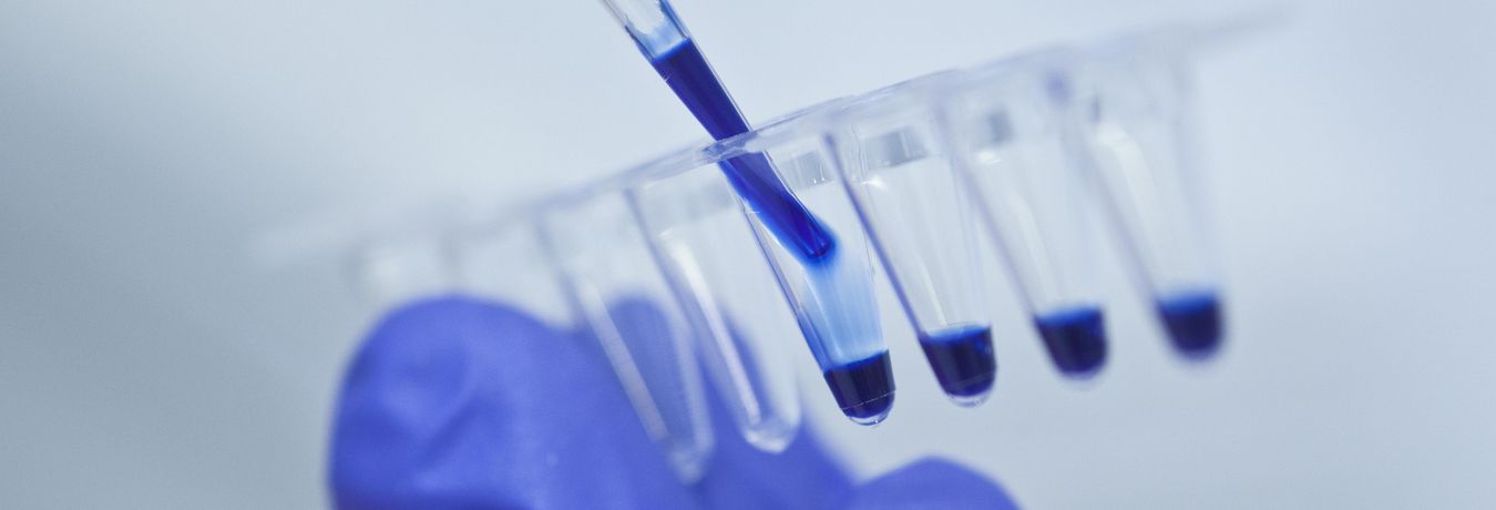 Blaue Flüssigkeit wird mit einer Pipette in durchsichtige Röhrchen verteilt