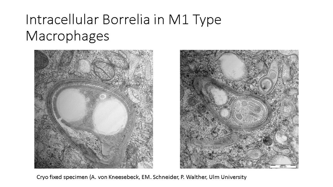 Studies in chronic and persistent Lyme Borreliosis: Intracellular Borrelia in M1 type macrophages