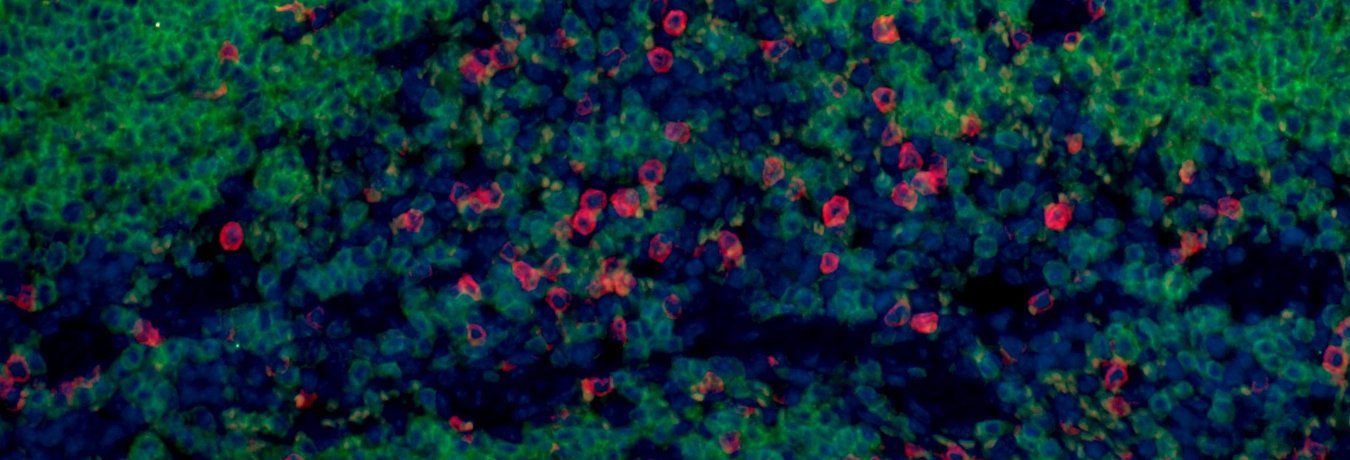 A mouse spleen during sepsis