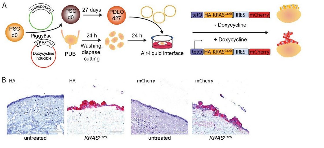 Schematic representation illustrating the propagation of pancreatic duct-like organoids (PDLOs) harboring a Tet-On expressing oncogenic HA-tagged KRASG12D and mCherry on porcine urinary bladder.