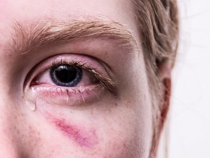 Blaues Auge