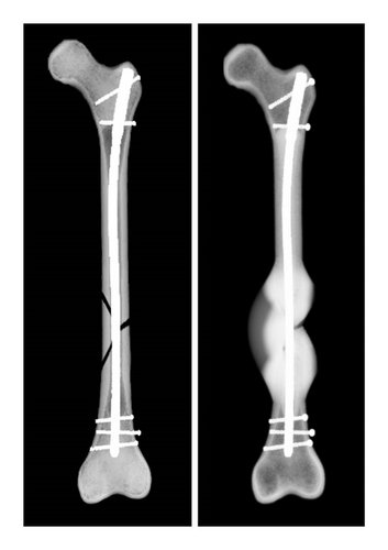 Computersimulation des Heilungsverlaufs eines Beispielpatienten