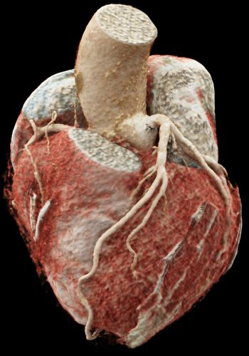 Abbildung des Herzens