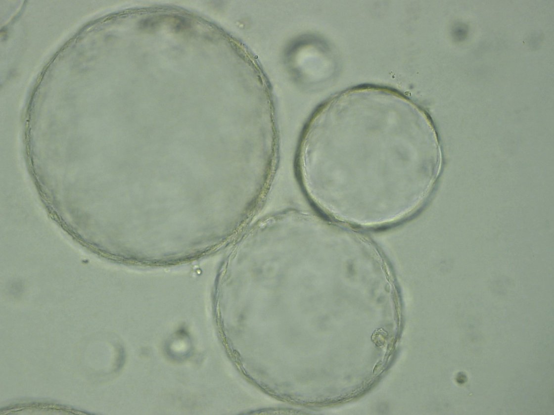 mikroskopische Aufnahme von Organoiden