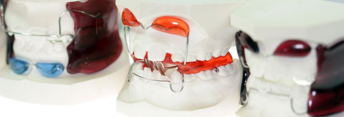 Abbildung: herausnehmbare Zahnspange am Modell