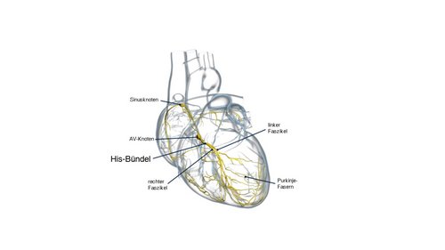 Das His-Bündel ist eine nur wenige Millimeter kleine Struktur im Herzen, wodurch ihre Lokalisation sehr komplex ist. (Quelle: Medtronic GmbH)