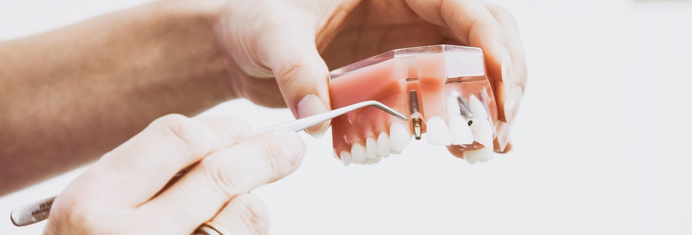 Ansicht eines Implantates am Zahnmodell