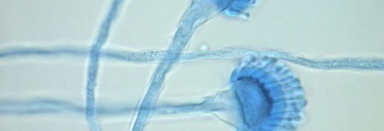 Aspergillus fumigatus