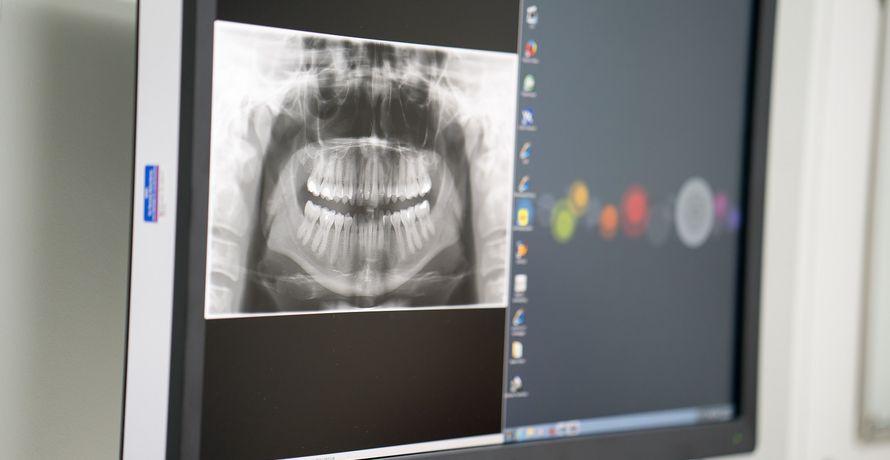 digitale Röntgenaufnahme auf dem Monitor